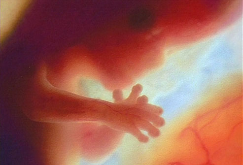 Congress Must Defund Planned Parenthood