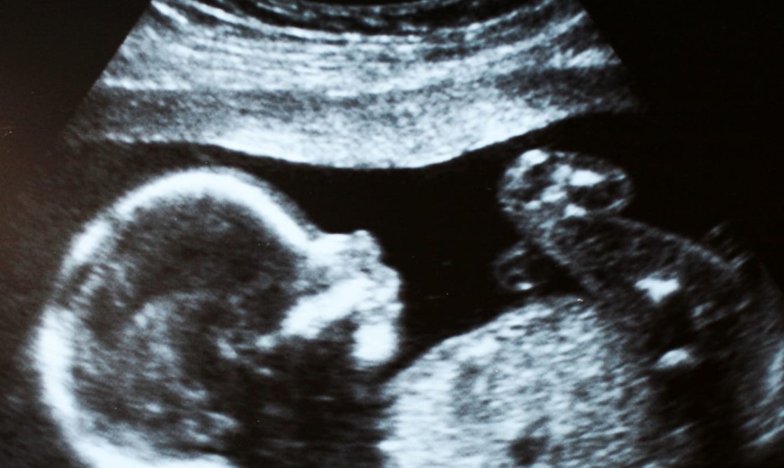 Disgusting: Dems Forcing You To Bail Out Abortion Industry